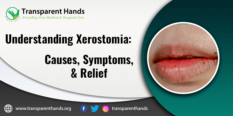 xerostomia