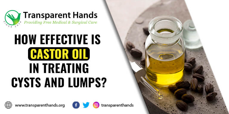 Castor Oil in Treating Cysts and Lumps