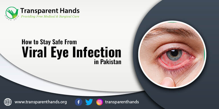 Viral Eye Infection in Pakistan