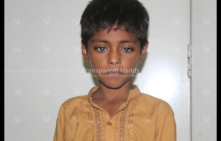 Muhammad Usman right lens aspiration and IOL GA Patients Pre image