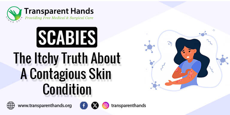 how to identify scabies