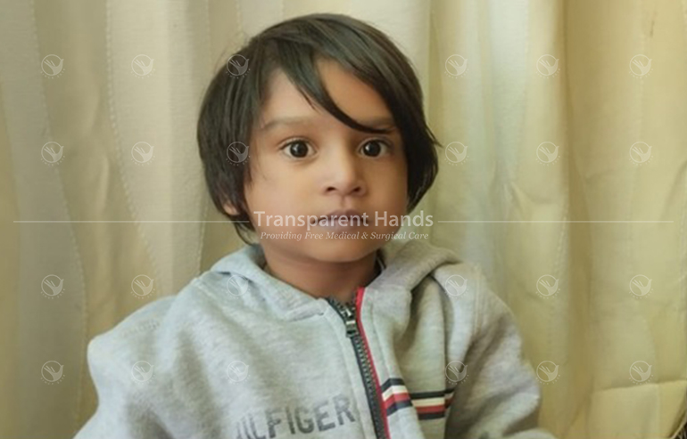 Aaliya Total Correction Surgery pre image