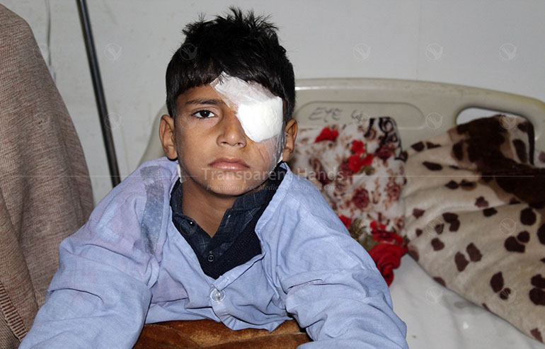 Muhammad Faraz B/L subluxated lens