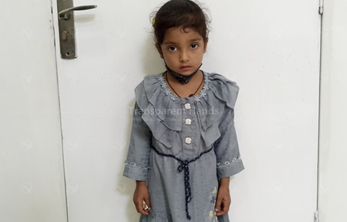 Ayesha Fatima Cataract Surgery Patient Pre Image