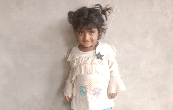 Hafsa cochlear implant patient pre image
