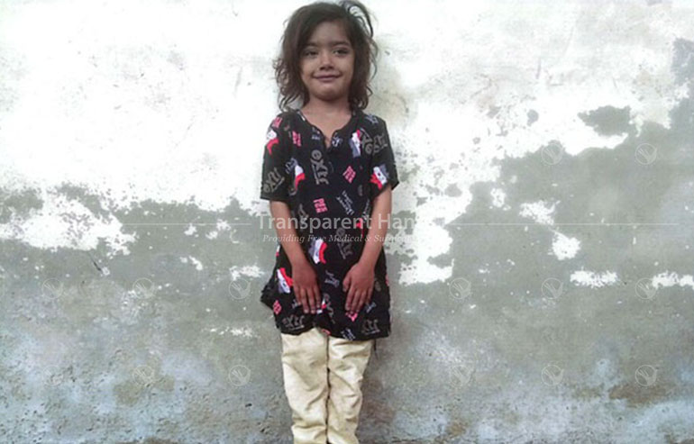 Iman Fatima pre operate image