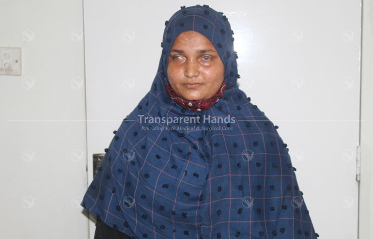 Iqra rab nawaz eye surgery patient pre image