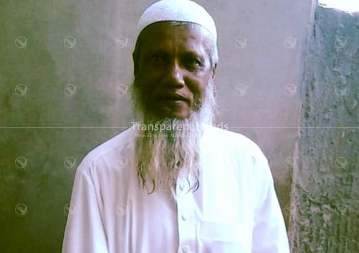 Jalal Ahmad hernia patient pre image