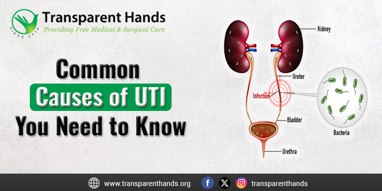 Common Causes of UTI You Need to Know