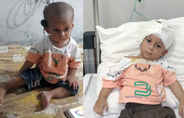 Muhammad ABdullah cochlear post image