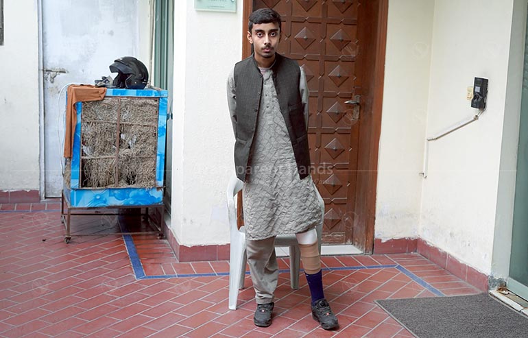 Raza Artificial Limb