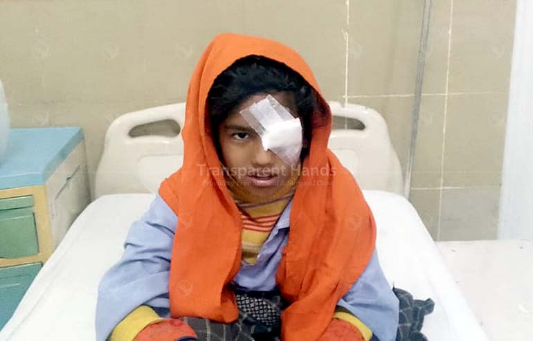 Shahnaz After Cataract