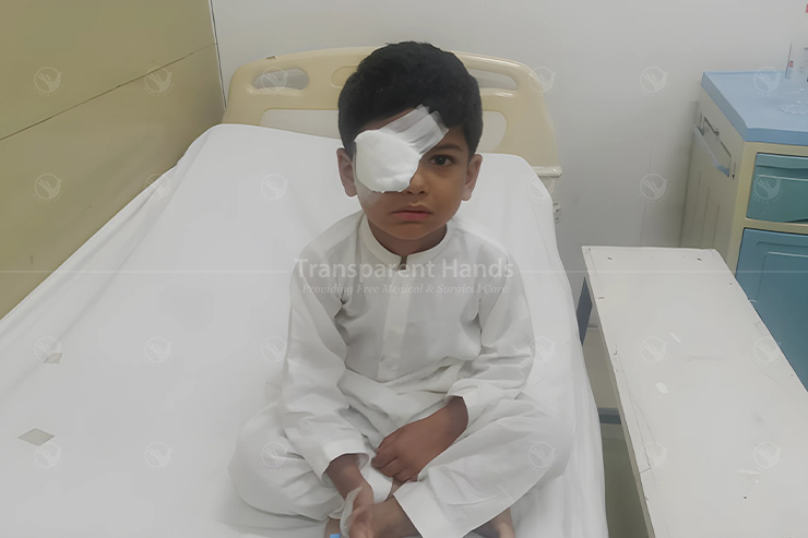 Cataract Surgery