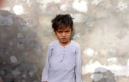 Ahmad’s Open-Heart Surgery