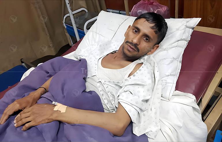 Chronic Anal Fissure