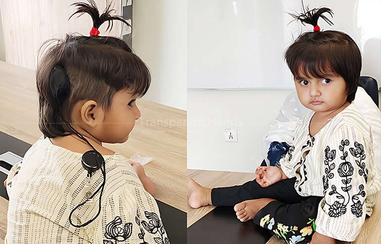 Cochlear Implant