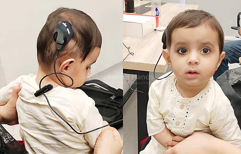 Cochlear Implant