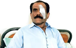 Cataract Surgery