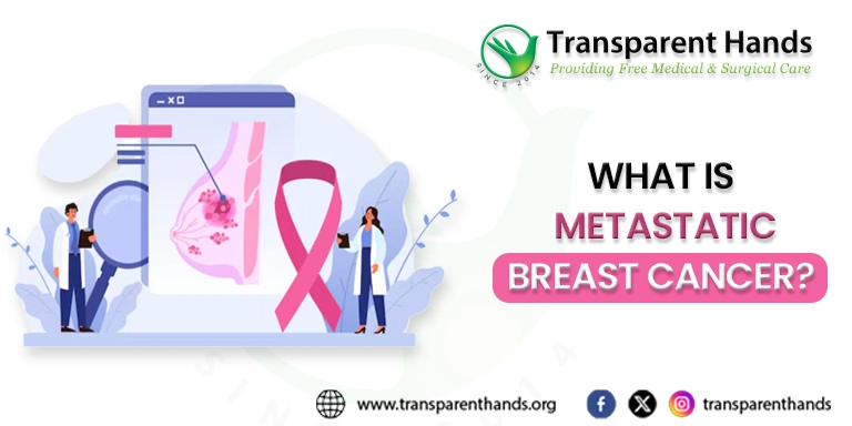 Metastatic Breast Cancer