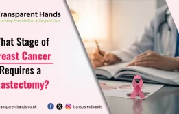 What Stage of Breast Cancer Requires a Mastectomy