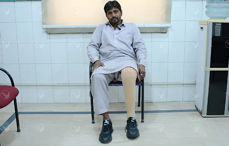 Transparent Hands patient recovering after treatment supported by donors