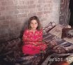 1782298172 Bahar Pre op 3